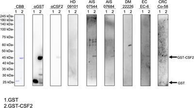 Utility of atherosclerosis-associated serum antibodies against colony-stimulating factor 2 in predicting the onset of acute ischemic stroke and prognosis of colorectal cancer